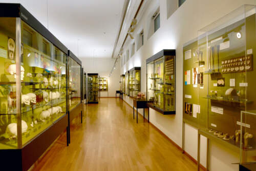 Anatomické Múzeum V Bazileji