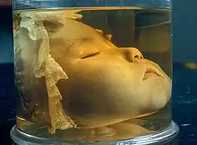 Anatomisch Museum Leiden