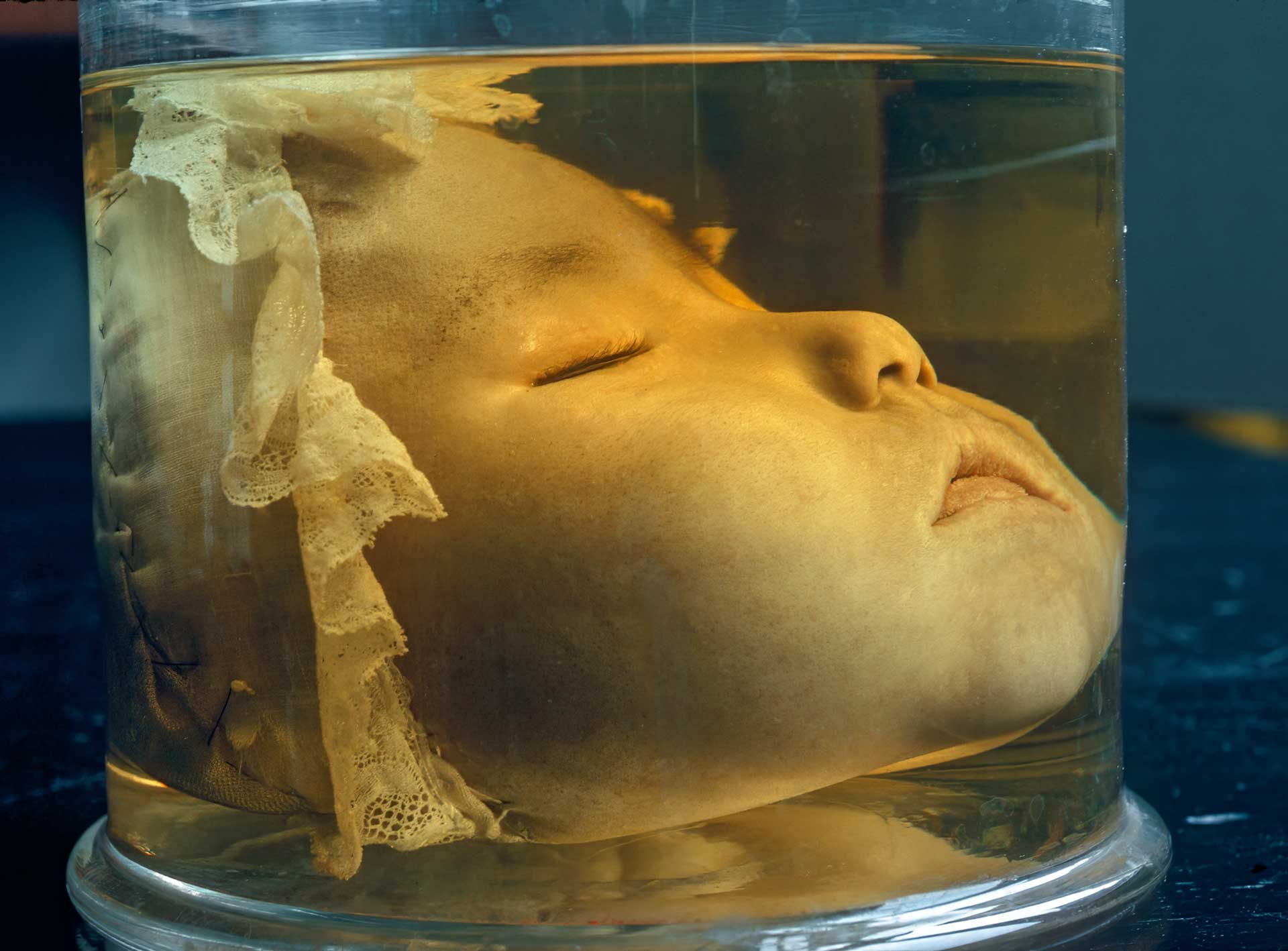 Anatomické múzeum v Leiden