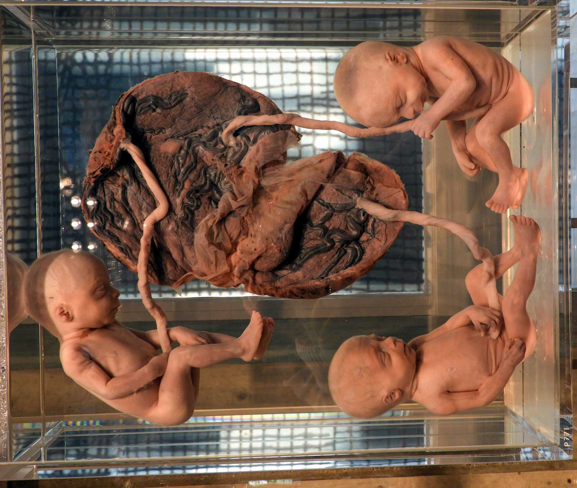 Anatomisch Museum Leiden