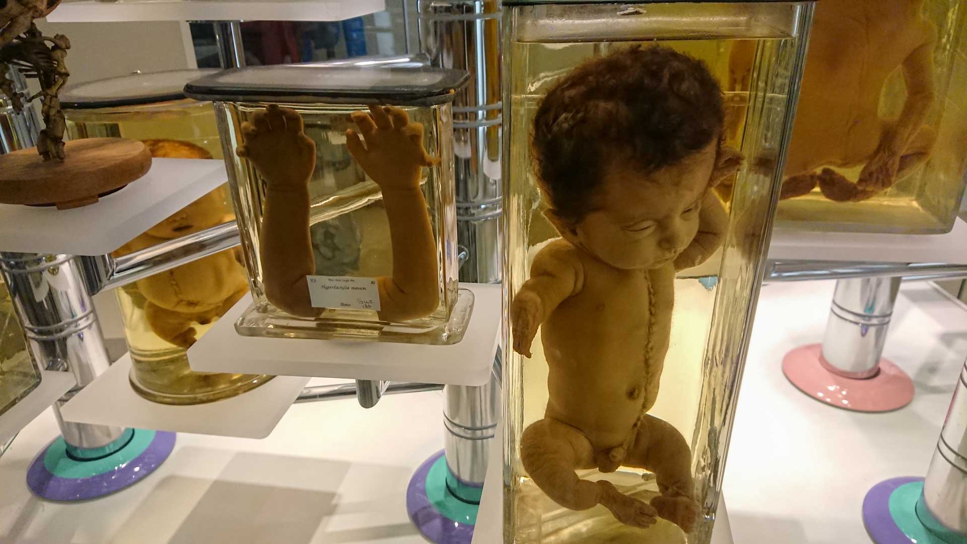 Anatomisch Museum Leiden