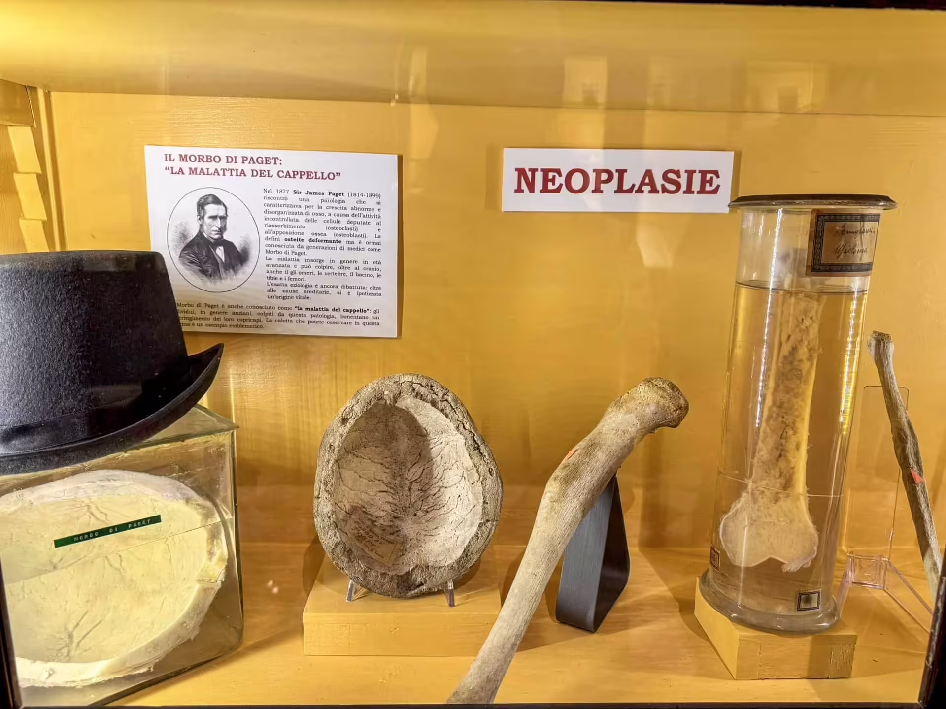 Múzeum patologickej anatómie