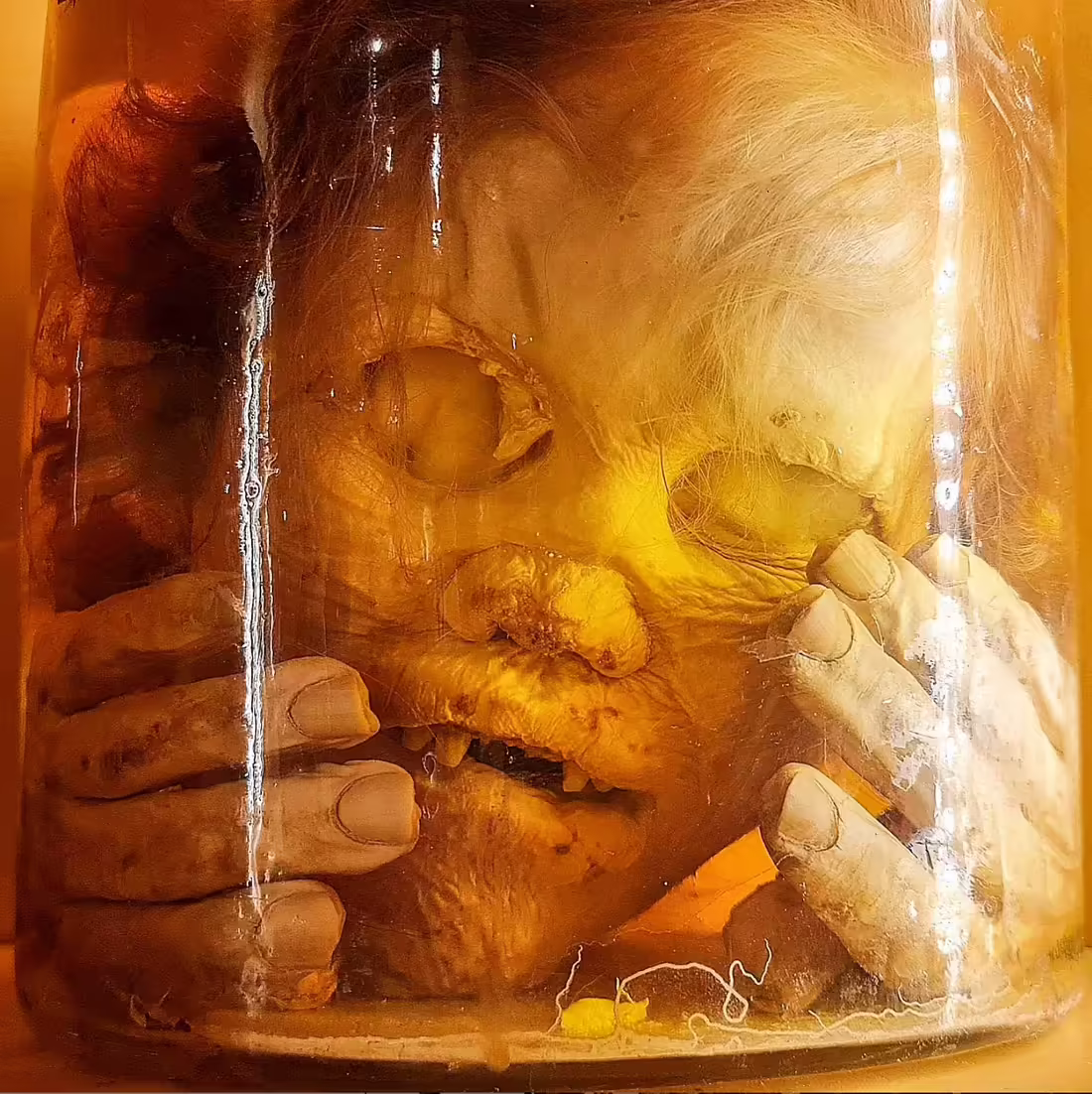 Ss Giovanni e Paolo Hospital - Museum of Pathological Anatomy